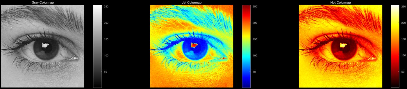 Eye image in gray, jet and hot colormaps